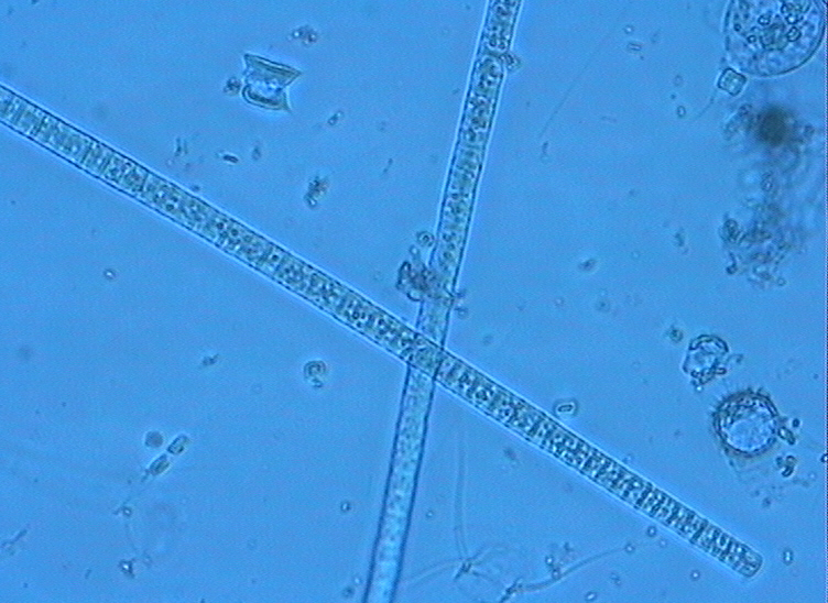 Dictyocha speculum